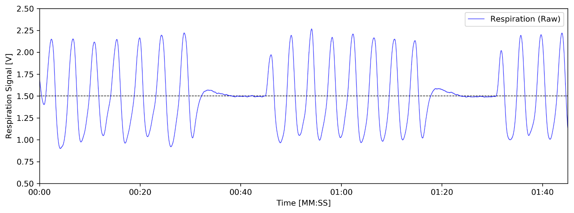 Reip Sensor How can I identify Apnea Phases using Inductive Respiration (RIP) Sensor?