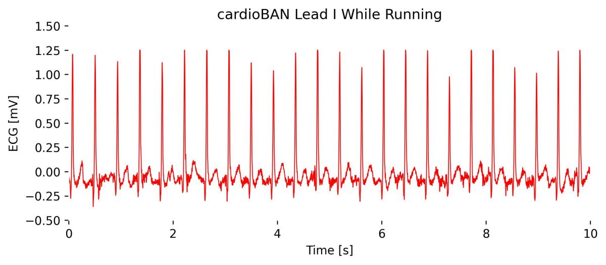 cardioBAN BLE: Sample Signals – Support PLUX Biosignals official