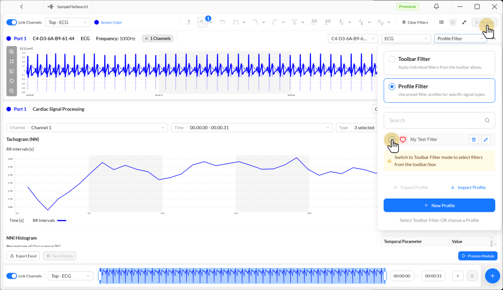 User interface displaying ECG data analysis with a blue waveform graph, tachogram, and NNI histogram, along with filter options for cardiac signal processing.