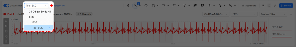 An interface displaying an electrocardiogram (ECG) waveform with options for channel selection and filtering settings.