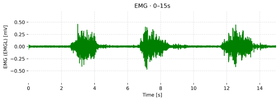A green audio wave visualization displaying sound amplitude over time with a grid background.
