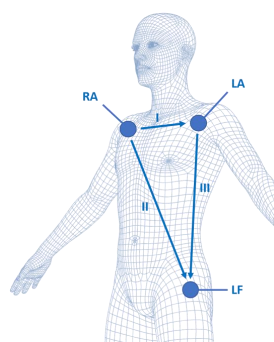 A wireframe depiction of a human body with labeled points for right arm (RA), left arm (LA), and left foot (LF), and lines indicating measurements or connections between these points.