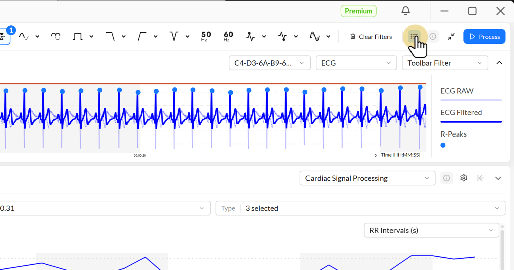 Screenshot of an ECG analysis interface displaying ECG raw and filtered signals with labeled R-Peaks and time indicators.