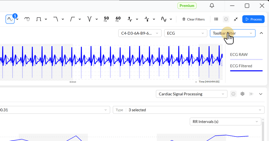 ECG waveform analysis interface displaying blue ECG signals with toolbar options for filtering and processing, including settings for cardiac signal processing and RR intervals.
