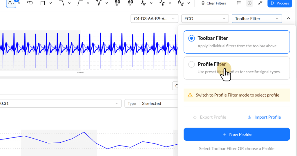 An ECG interface displaying a blue waveform, with options for applying filters and exporting profiles.