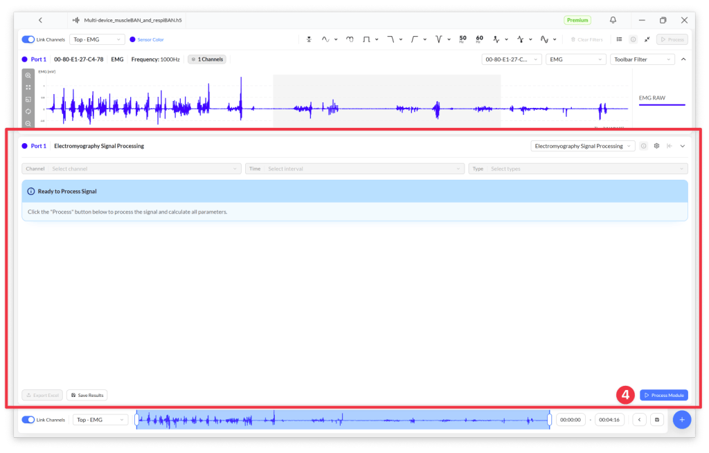 Screenshot of an electromyography signal processing software interface displaying signal waveforms and processing options.