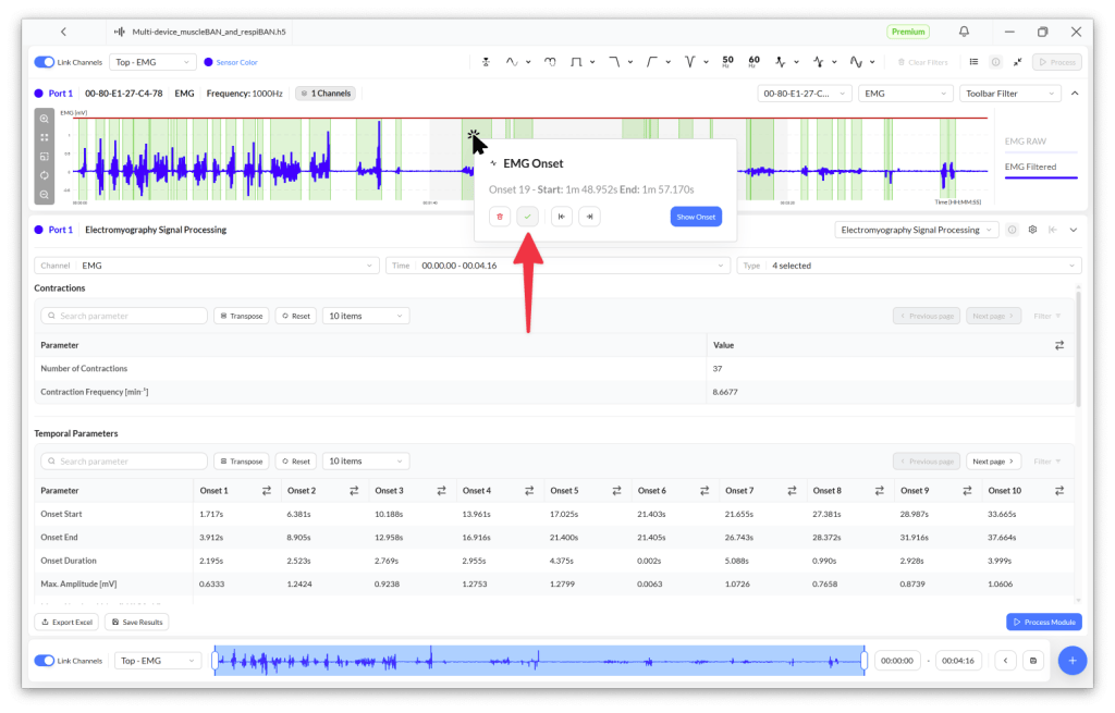 Screenshot of an electromyography (EMG) signal processing software interface displaying EMG waveform, contraction parameters, and temporal measurements.