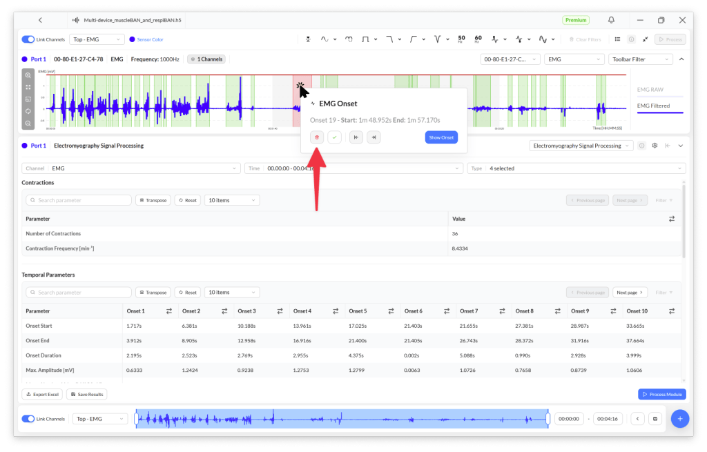 Screenshot of an electromyography (EMG) analysis tool displaying EMG waveforms, contraction parameters, and onset details with highlighted sections.