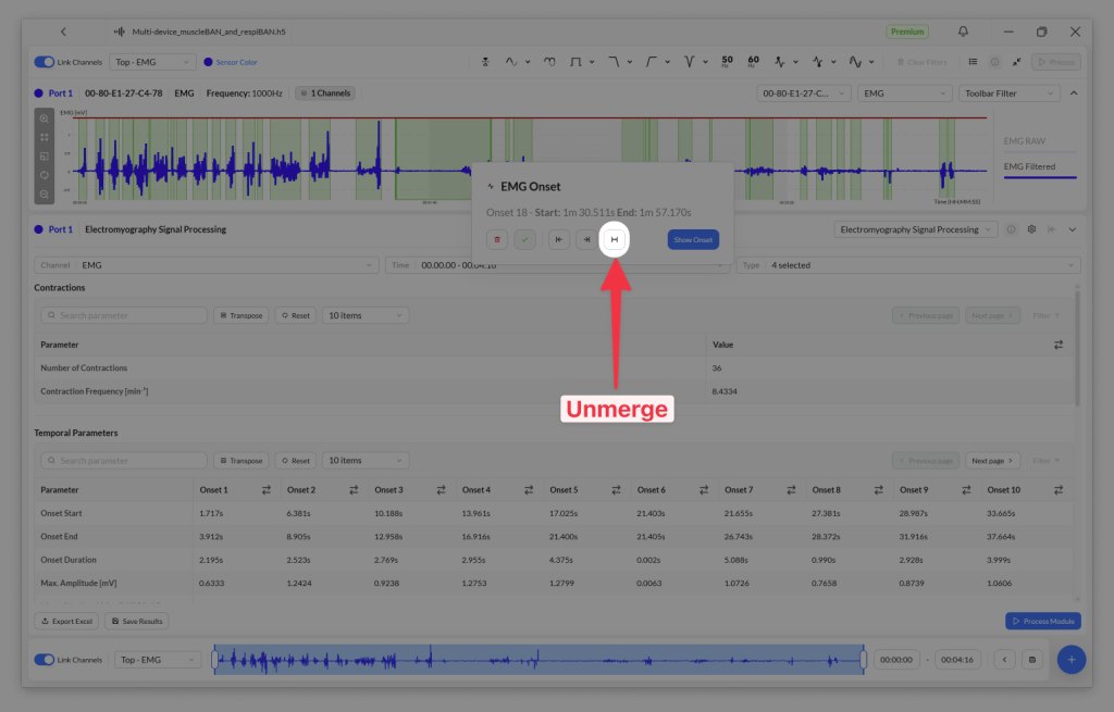 Screenshot of an electromyography analysis software interface displaying EMG signal processing data, with a highlighted 'Unmerge' button for editing contraction parameters.