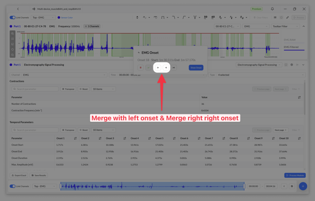 Screenshot of an electromyography (EMG) signal processing software displaying waveforms and parameters for data analysis with highlighted merge options.