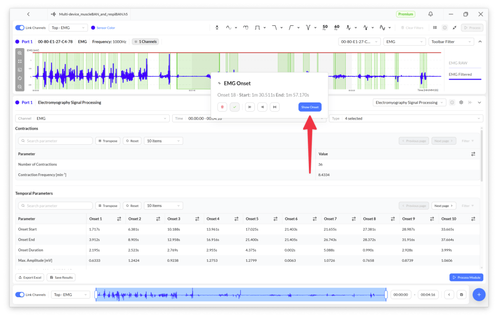 A screenshot of an electromyography (EMG) analysis software interface, displaying the EMG signal waveform, onset parameters, and contraction details, with annotated start and end times.