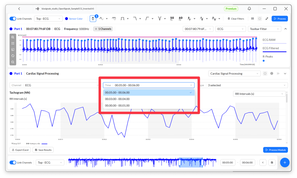 Screenshot of an ECG signal analysis interface showing raw and filtered ECG data along with cardiac signal processing options and a time selection dropdown.